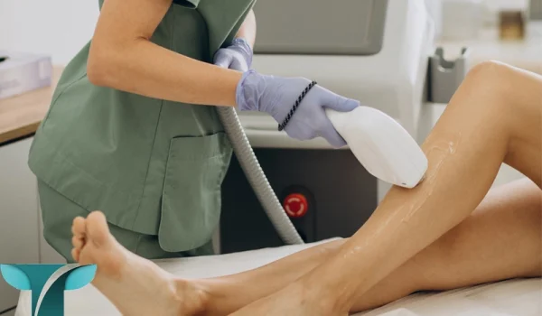 مراقبت بعد لیزر